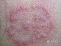 沈阳惠洱通健康管理有限公司